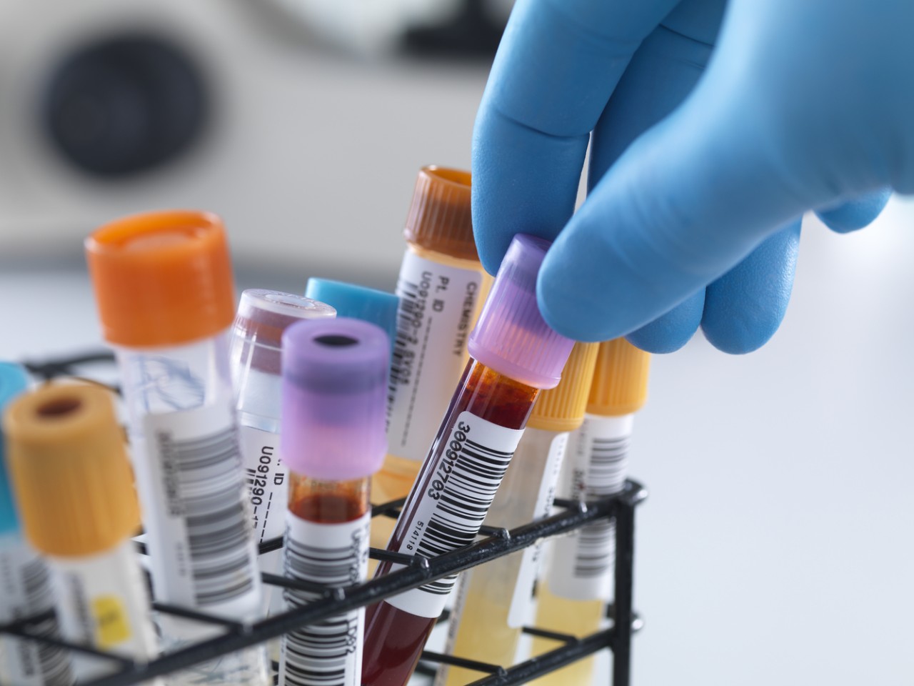 一致性评价大幕开启，医院市场即将调解