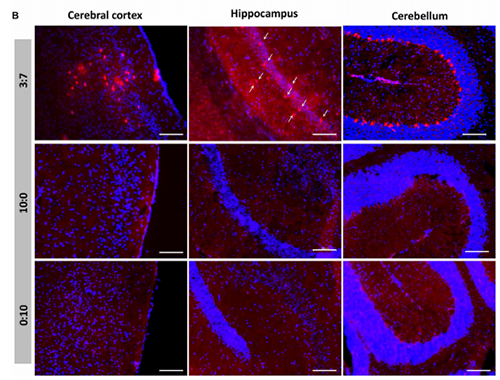 被包裹在含有NT-类脂质的LNP中的Cre重组酶乐成转移。大脑中的转染神经元呈红色高亮。