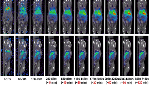 尊龙凯时PET/CT分子影像手艺平台