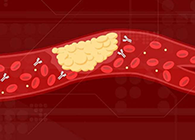 【Science速递】攻克COVID-19里程碑：已确定血凝块形成缘故原由！