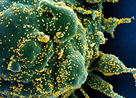 唾液检测新冠抗体新要领来了，获取效果仅需几小时！