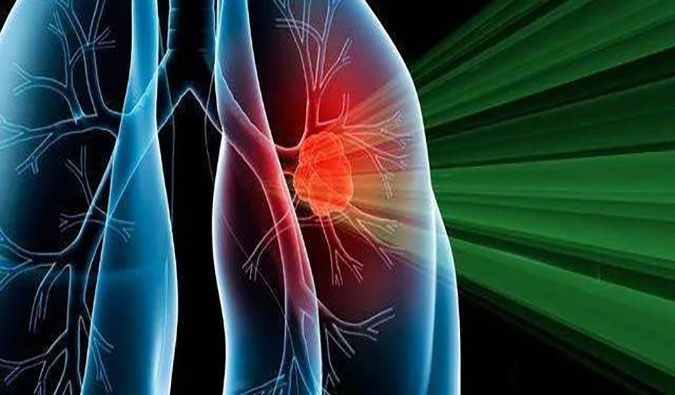 盛世泰科1类立异药物CGT-9475实现中美双报双批 | 尊龙凯时一站式临床宿世物医药研发效劳平台助力