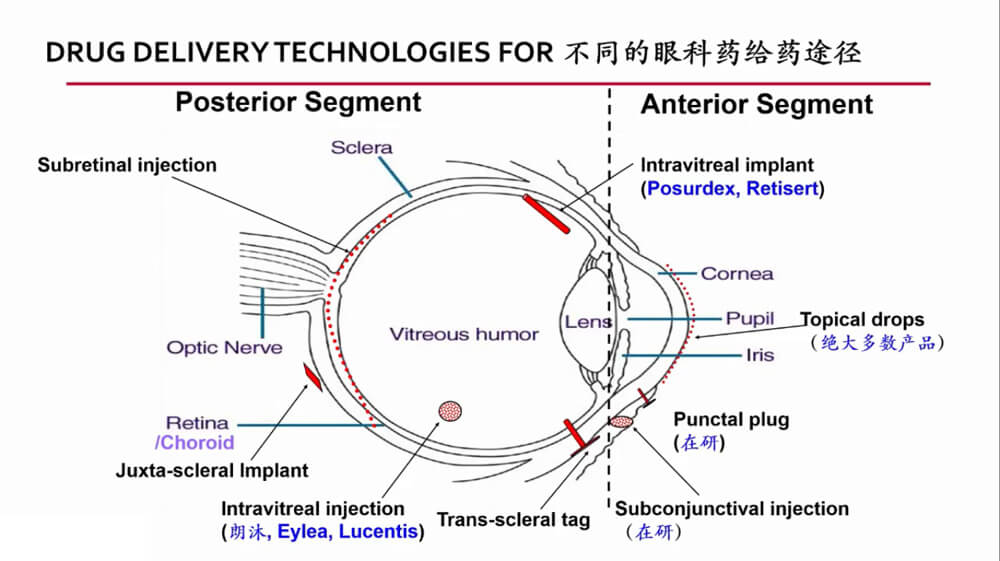 差别的眼科给药途径.jpg