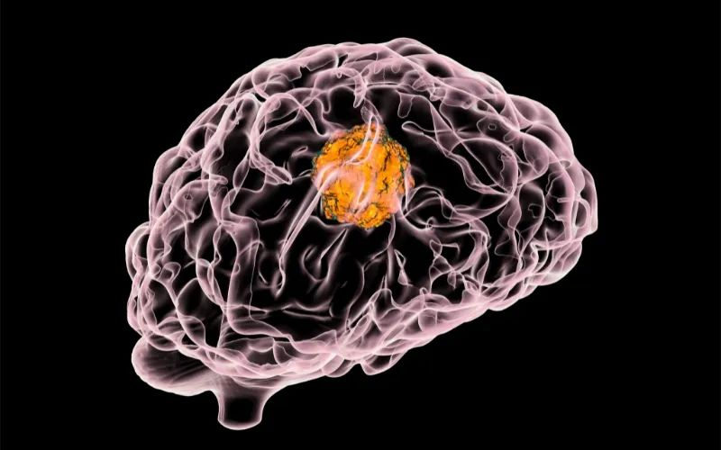 尊龙凯时助力 | 璧辰医药ABM-1310获美国FDA孤儿药资格认证，用于治疗携带BRAF V600突变的脑胶质母细胞瘤患者