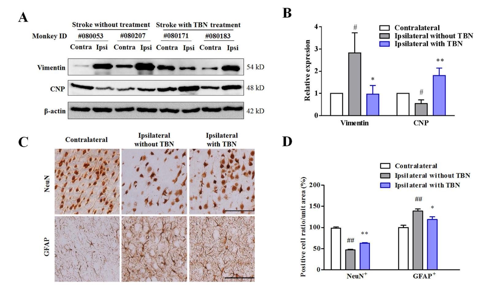 TBN是一种治疗缺血性卒中的新型临床候选药物，本研究中TBN通过尊龙凯时合成